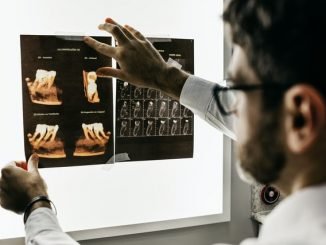Компьютерная томография. 3D-снимок зубов