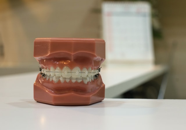 Диагностика заболевания зубов